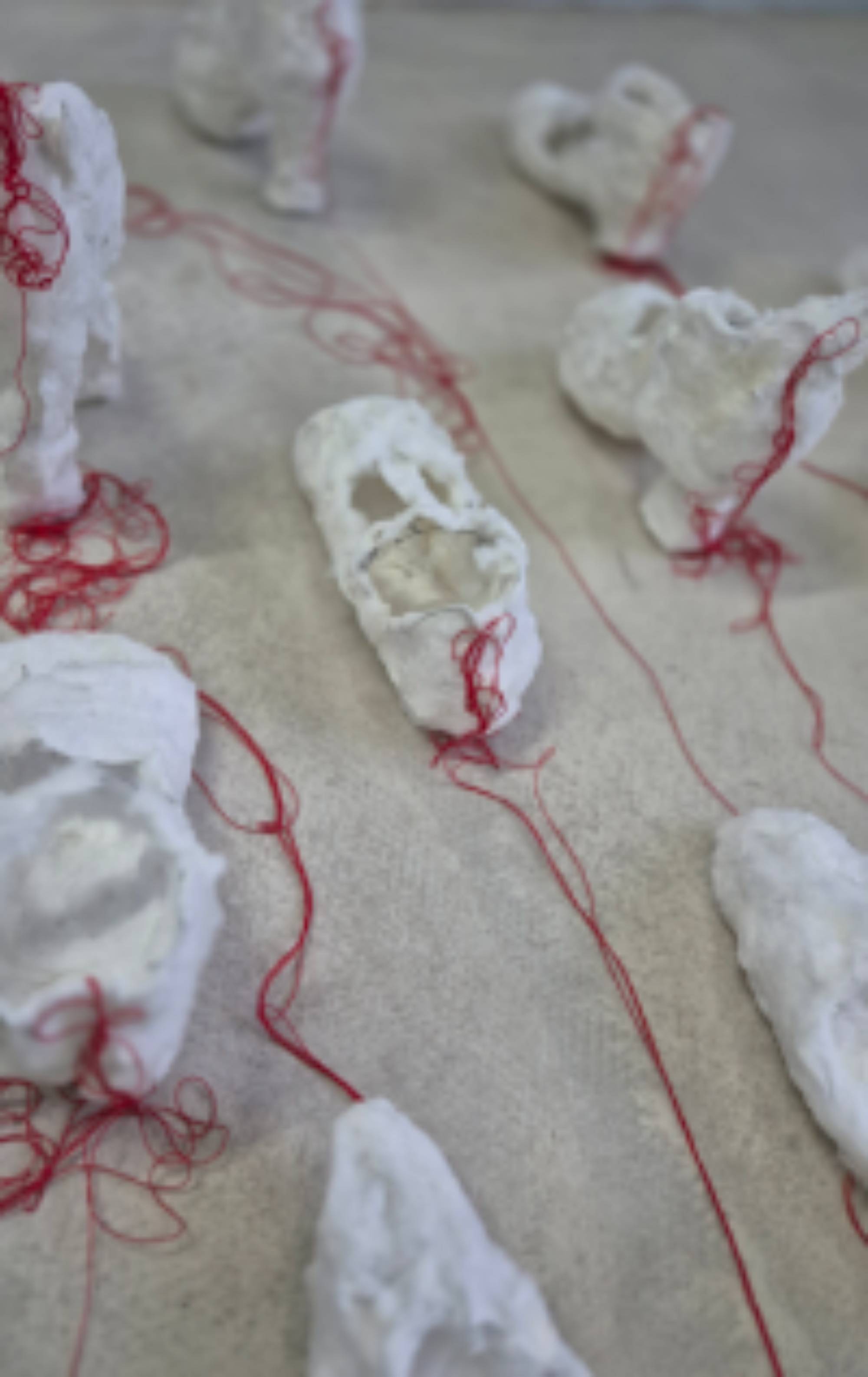 cover Installation and Performance "no longer hurt" for "Dream Gap"